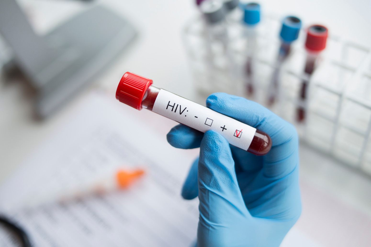 Alarm svetskih stručnjaka: Zabrinjavajuća nestašica ključnih lekova za HIV