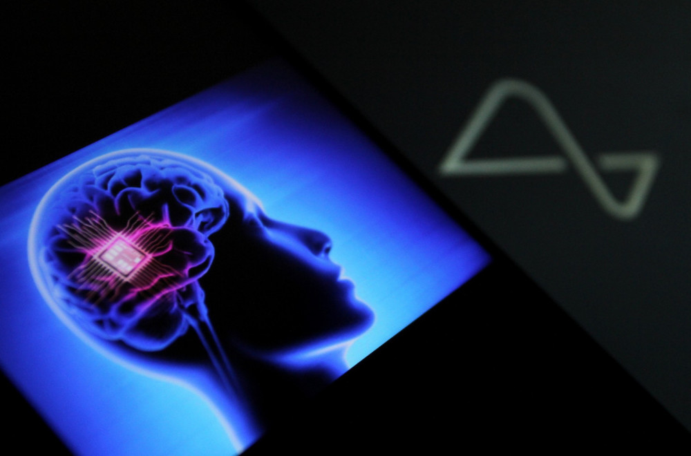 Kvar na Neuralink čipu u mozgu: Maskova firma htela da ga ukloni