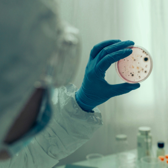 Izbila epidemija kolere: Umrlo 58 ljudi