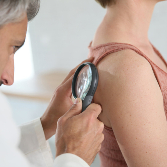 Zašto je važan preventivni dermatološki pregled? VIDEO