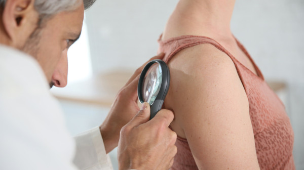 Rani znaci raka: Pet simptoma koje ne smete ignorisati, a često su zanemareni