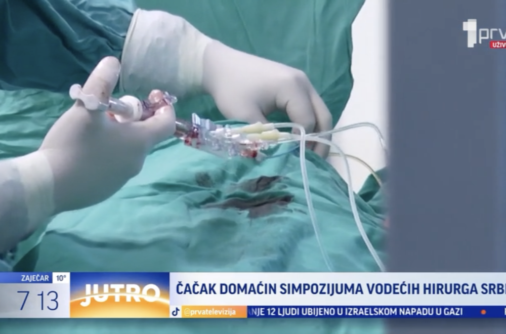 Čačak domaćin Simpozijuma vodećih hirurga Srbije VIDEO