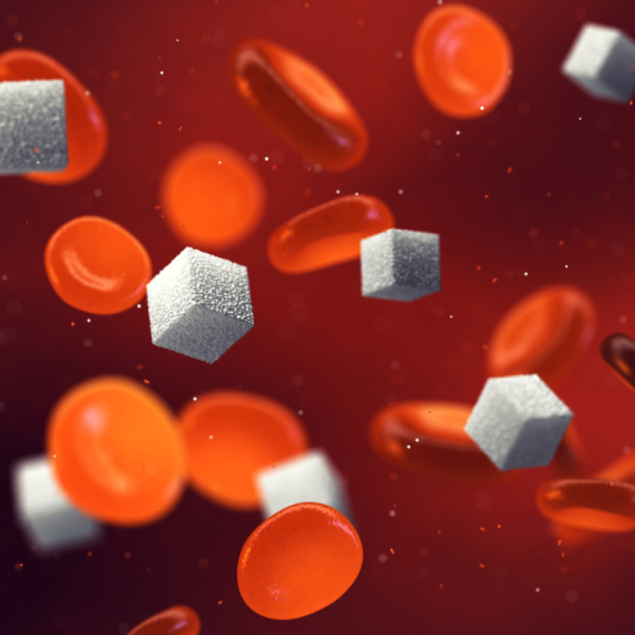 Pet znakova insulinske rezistencije koje zanemarujemo