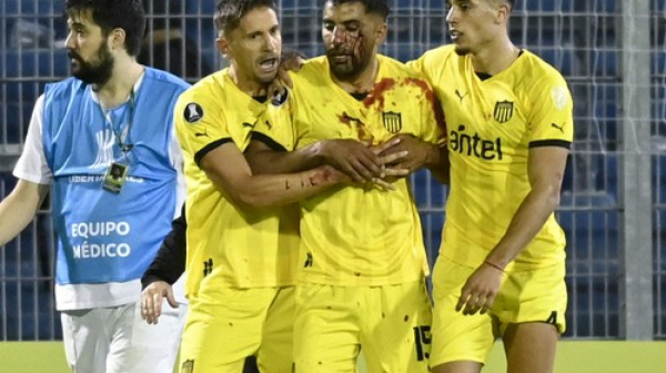 Krvav početak Kopa Libertadores – sramota Argentinaca VIDEO