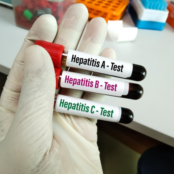 Ukidaju vakcinu protiv hepatitisa? "Ne činite pre ovog perioda"