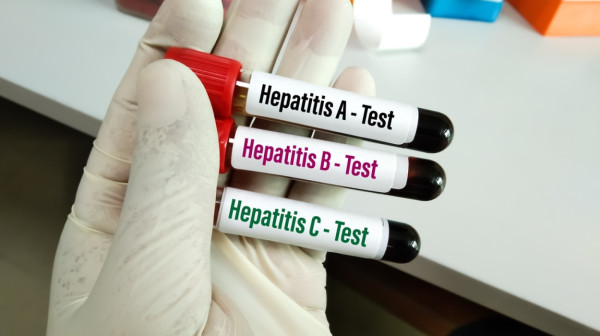 Ukidaju vakcinu protiv hepatitisa? "Ne činite pre ovog perioda"