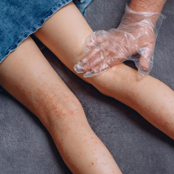 Tri sestre u Srbiji pate od neizlečive bolesti: Ovo je njihova priča  VIDEO