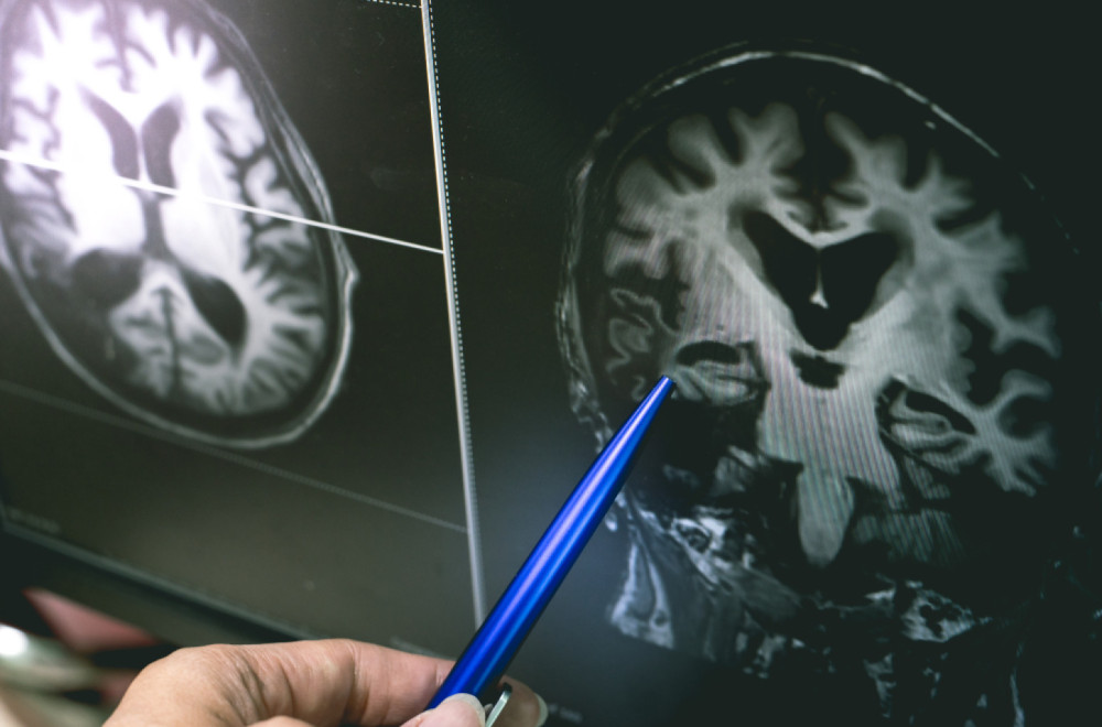 Naučnici otkrili novu funkciju malog mozga