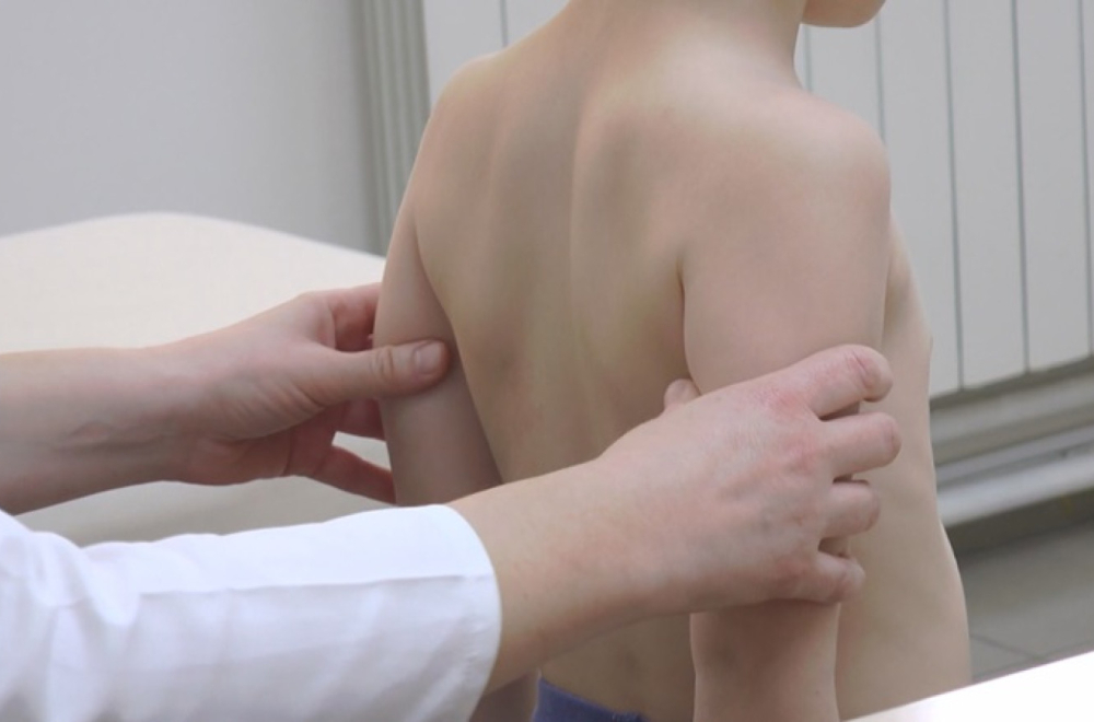 Sve više dece u Srbiji ima ovaj problem: Nepravilno sedenje i ishrana glavni krivci