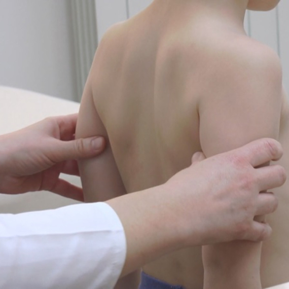 Sve više dece u Srbiji ima ovaj problem: Nepravilno sedenje i ishrana glavni krivci