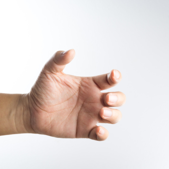 Ovaj simptom koji se vidi na prstima nikako ne smete da zanemarite