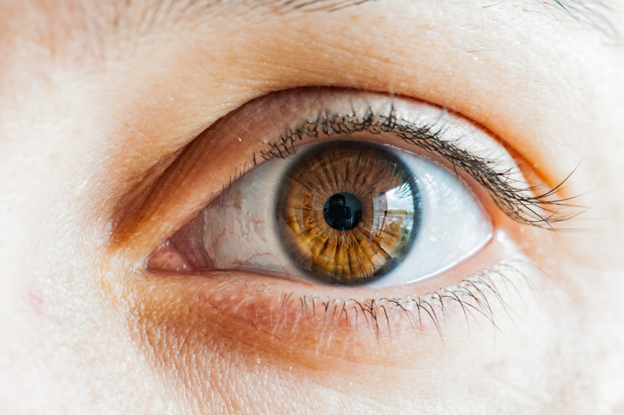 Nema više liste čekanja za operaciju katarakte u Srbiji