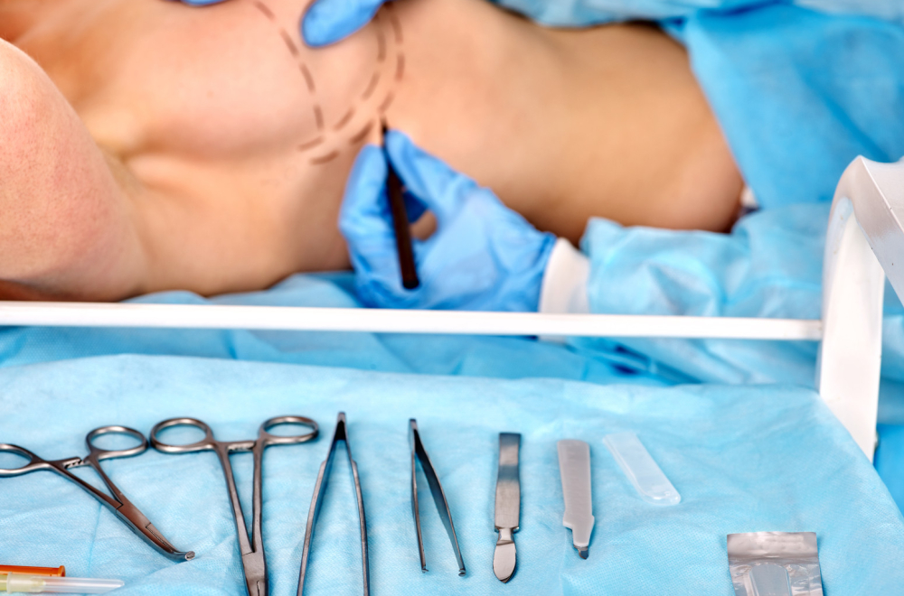 Doživela užas nakon operacije grudi u Turskoj: "Moja bradavica je visila"