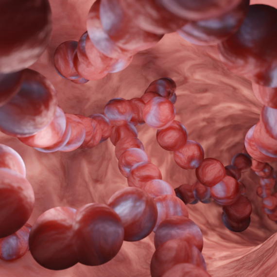 Širi se bolest koja "izjeda" mišiće: Uzrokuje je bakterija, a može postati fatalna za 48 sati