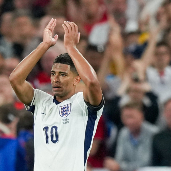 Belingem ima nesvakidašnji poremećaj: Čudne mrlje na licu najbolji su pokazatelj