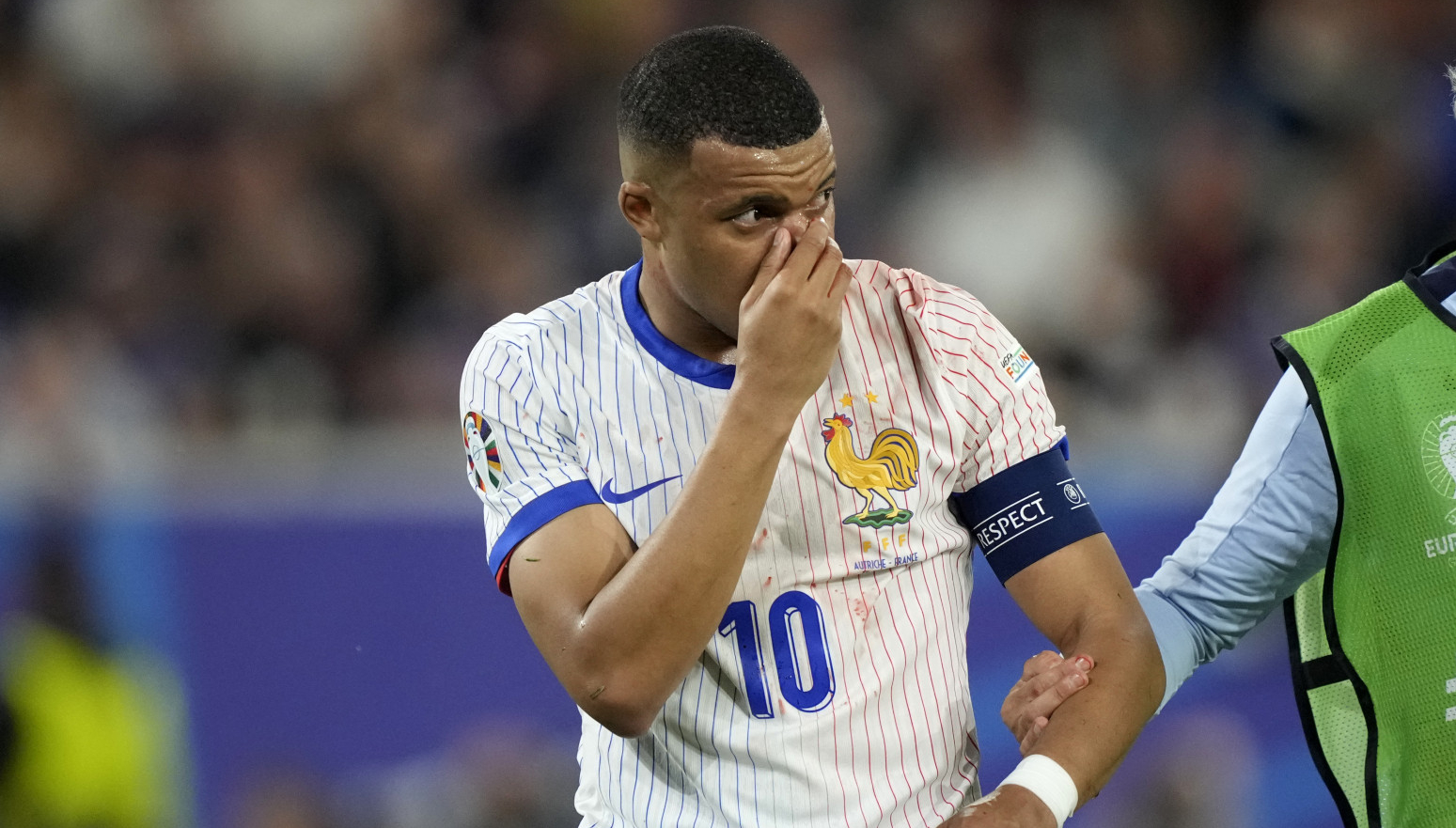 Mbape će igrati sa slomljenim nosem – "Ima li neko ideju za masku?"