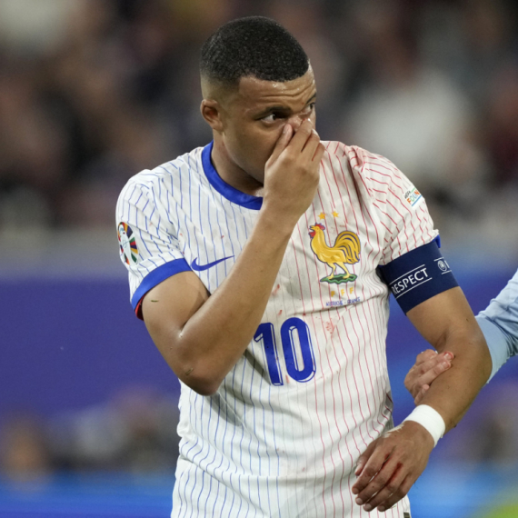 Mbape će igrati sa slomljenim nosem – "Ima li neko ideju za masku?"