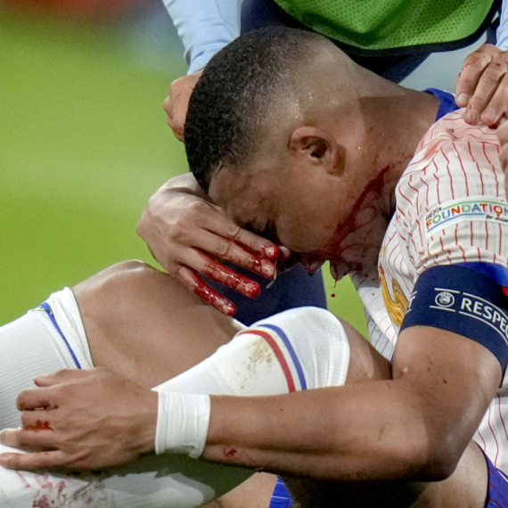 Mbape mora na operaciju!