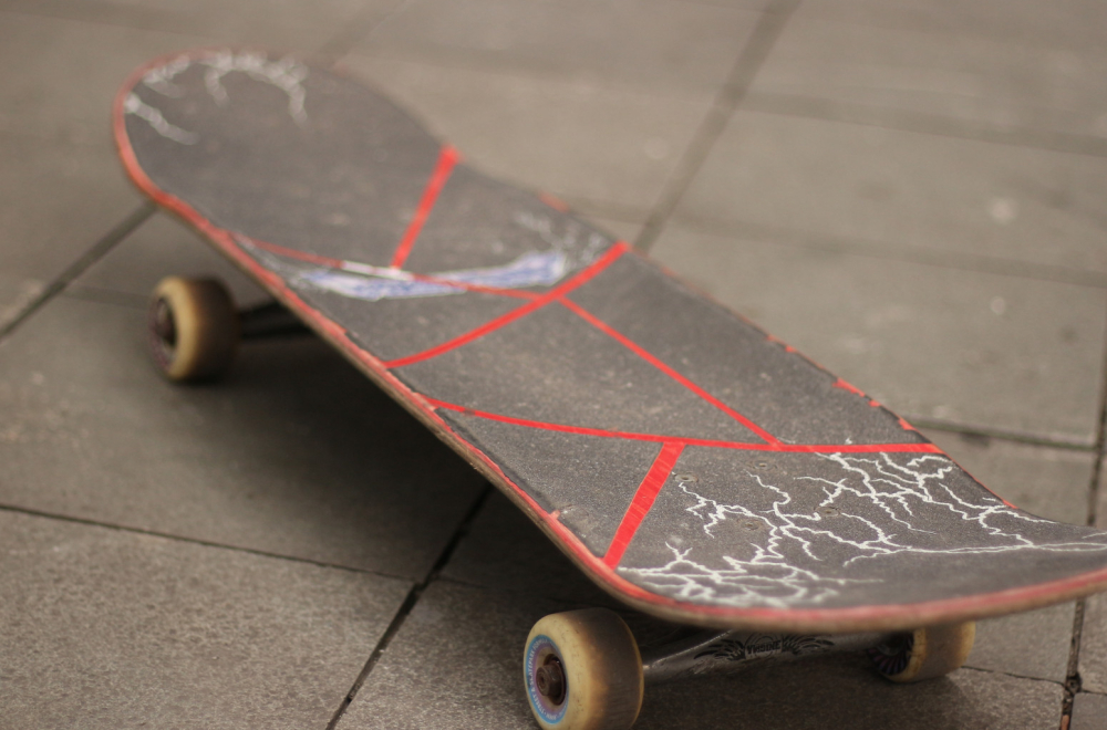 Ako ste ovo kupili, vratite u prodavnicu: Opasnost od povreda