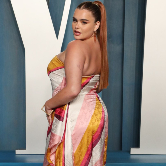 Bila je omiljena bucka Holivuda, a onda se odjednom prepolovila: Šta se desilo? FOTO