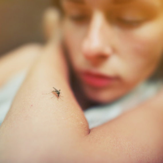 Panika u Hrvatskoj: Turisti prijavili neobične fleke po koži koje peku FOTO