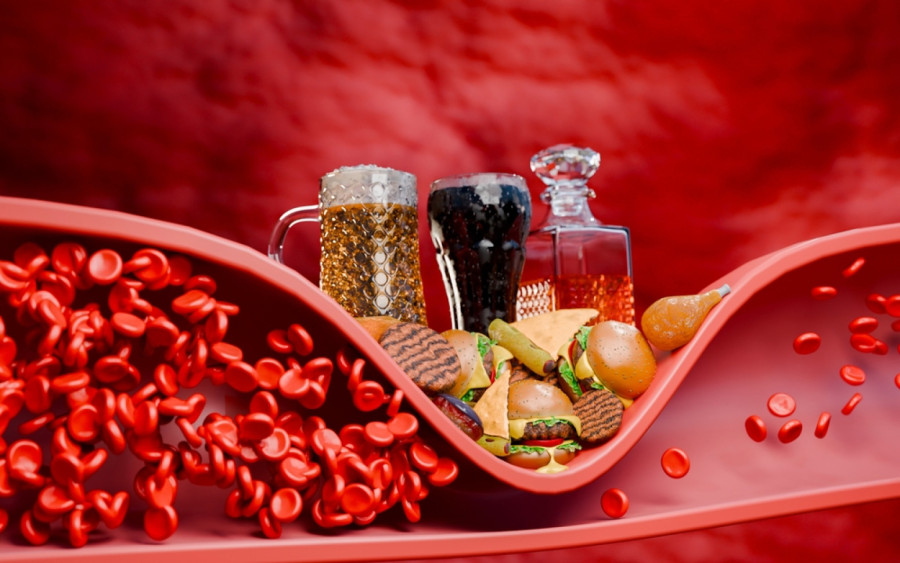 Kako sniziti holesterol bez lekova?