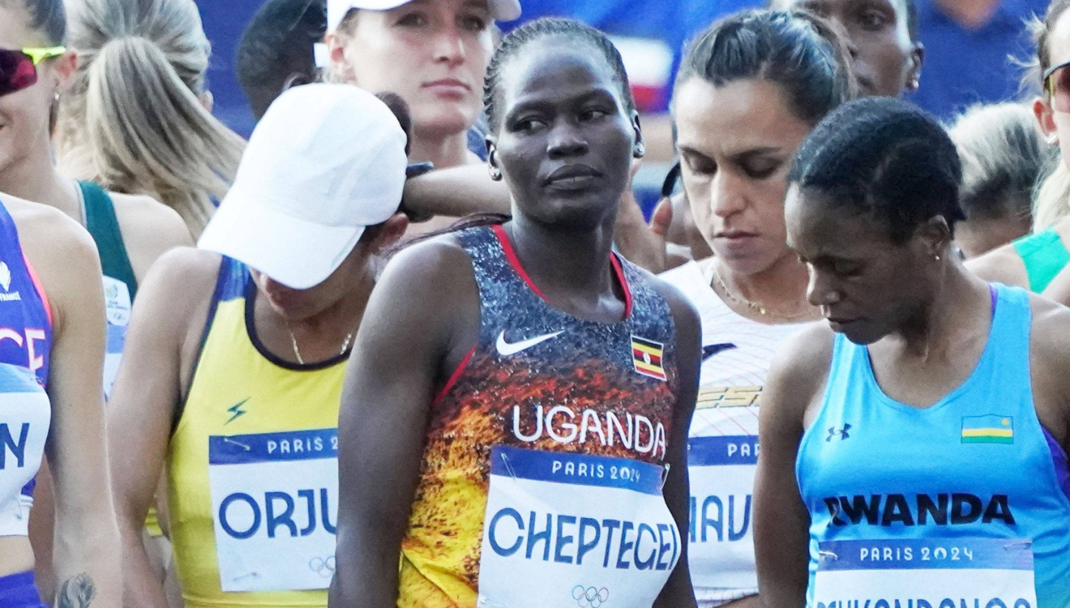 Zapalio i ubio devojku, pa podlegao povredama