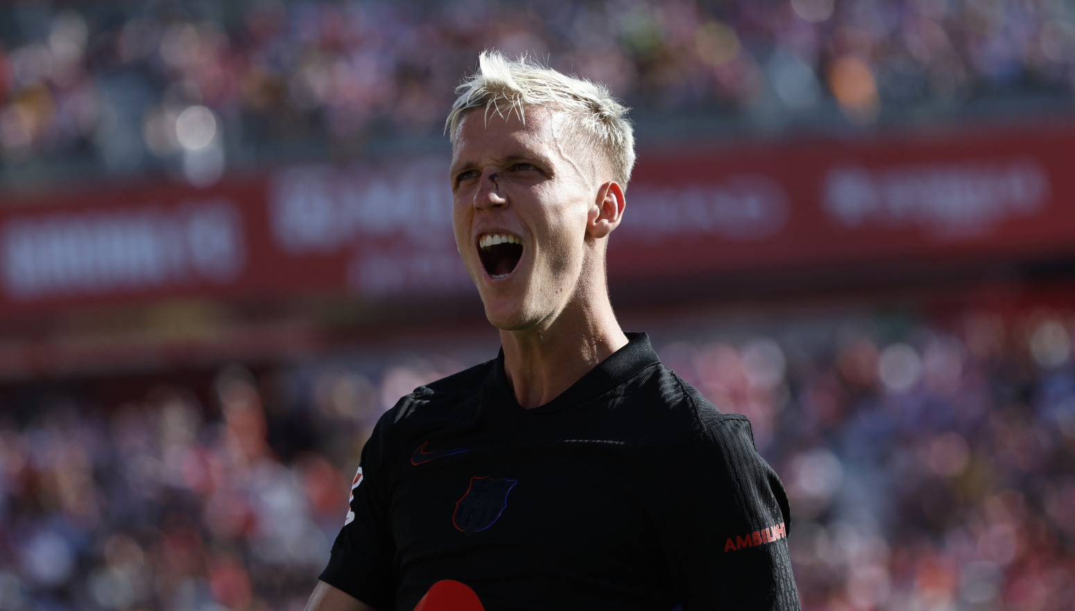 Povređen Olmo – poznato koliko Barsa čeka Danija