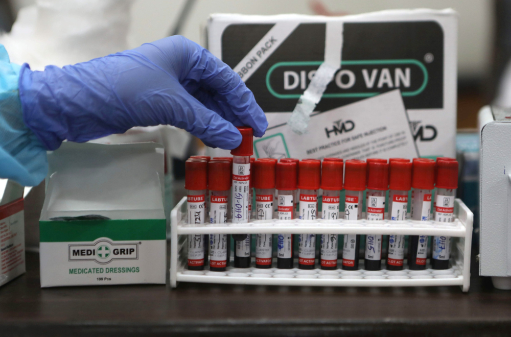 Ceđena pomorandža, pivo ili čaj od kamilice: Šta piti, a šta izbegavati u odnosu na krvnu grupu