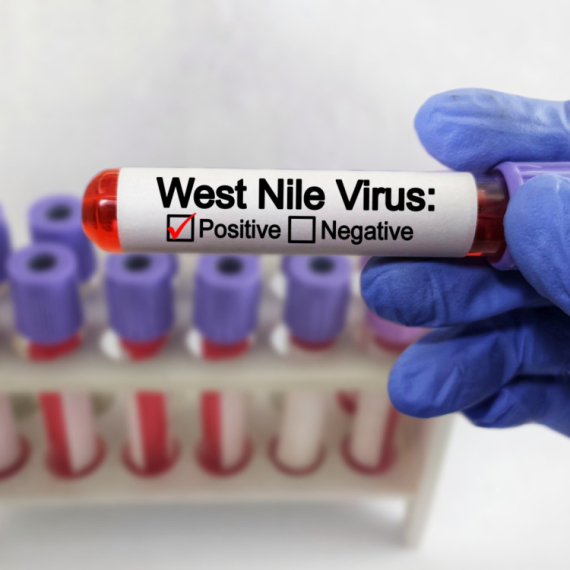 Virus se širi Srbijom, registrovani novi slučajevi