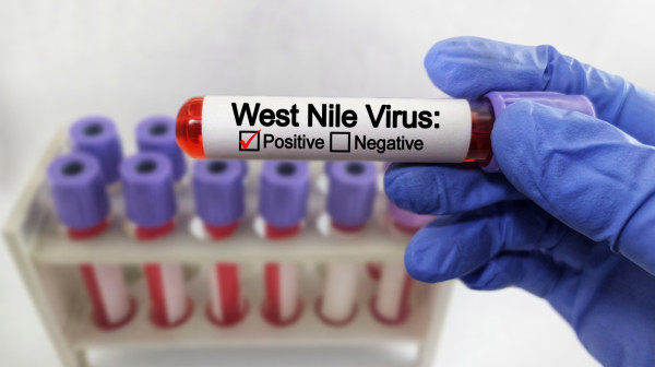 Virus koji prenose komarci stigao u Severnu Makedoniju: Dva pacijenta hospitalizovana