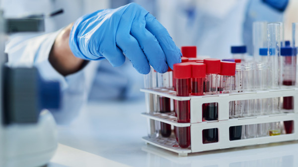 Terrible news from Bosnia-Herzegovina: Mass poisoning of population; trace of heavy metals in children's blood