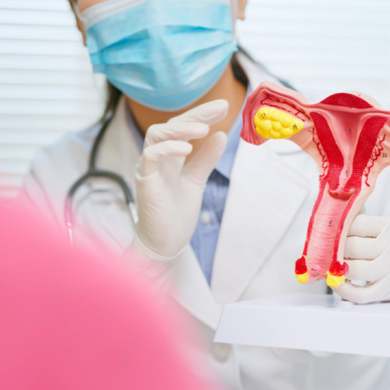 Naučnici razvili medicinski tampon koji može da otkrije rane znakove raka jajnika