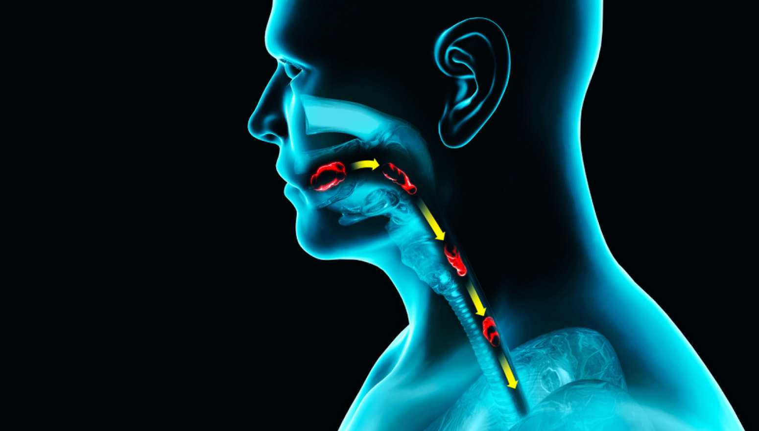 Inovativna terapija za lečenje eozinofilnog ezofagitisa veoma uspešna VIDEO