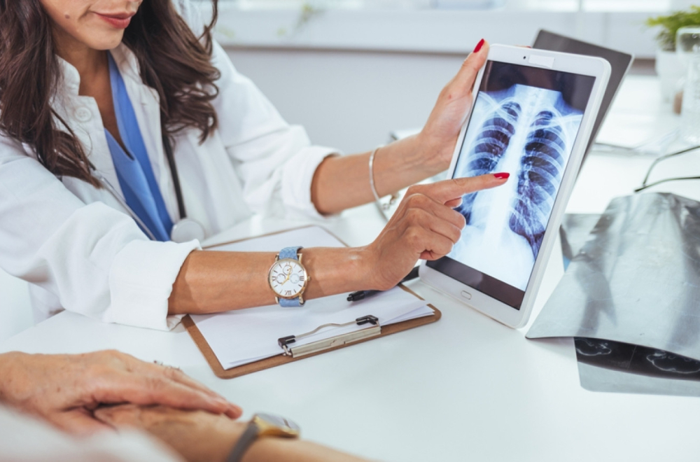 Ogromno interesovanje za skrining na rano otkrivanje raka pluća