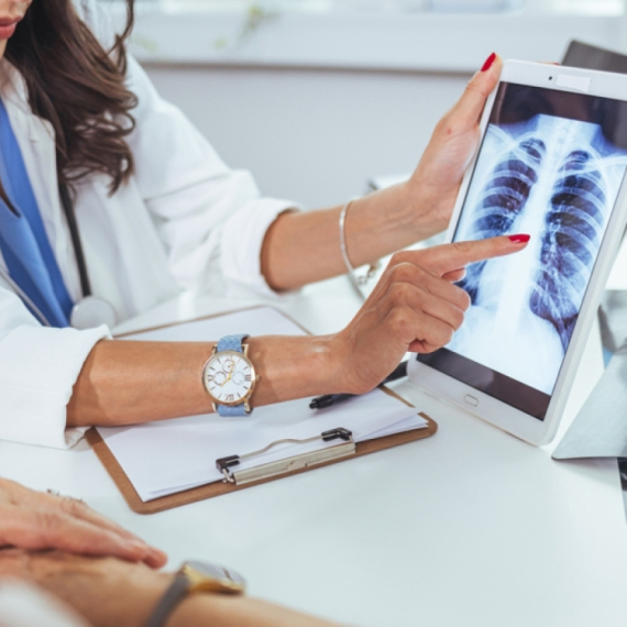 Besplatan skrining karcinoma pluća u svim opštinama Šumadijskog okruga