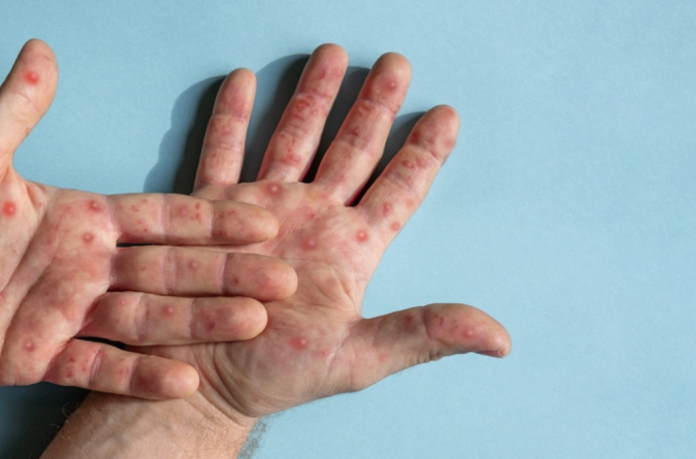 Pedijatar upozorava roditelje: Nikad ne izlažite decu ovome VIDEO