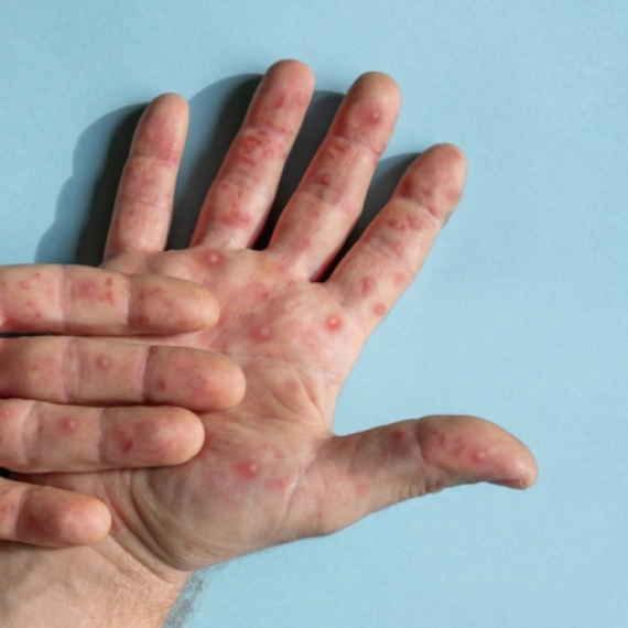 Pedijatar upozorava roditelje: Nikad ne izlažite decu ovome VIDEO