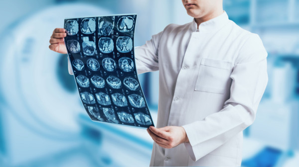 Jednostavan test iz krvi mogao bi spasiti živote obolelih od tumora mozga