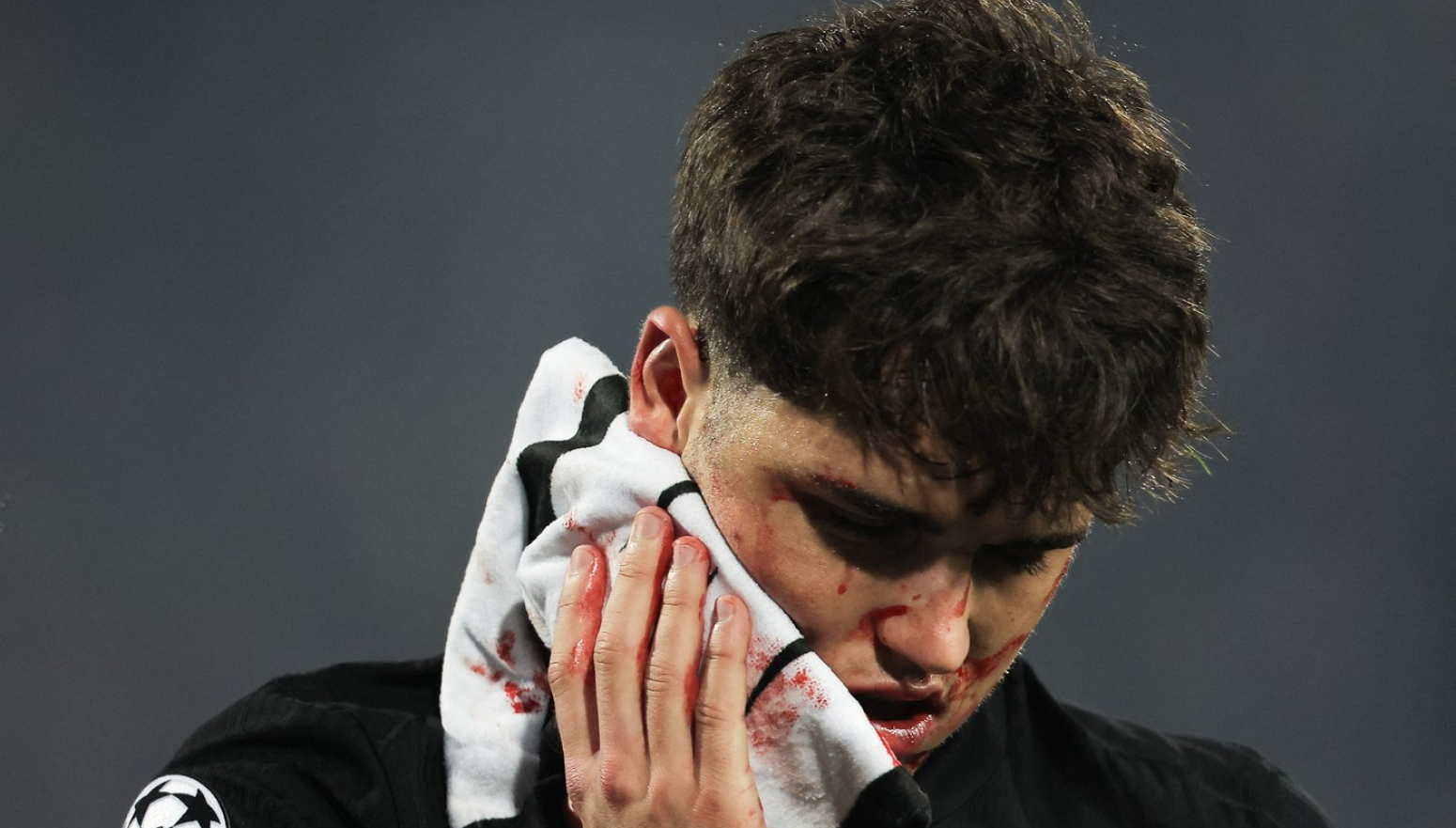 Na "Marakani" pretrpeo horor – želi da igra već za vikend