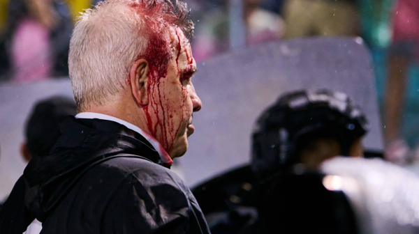 Razbili glavu selektoru, suspendovani jednu utakmicu VIDEO