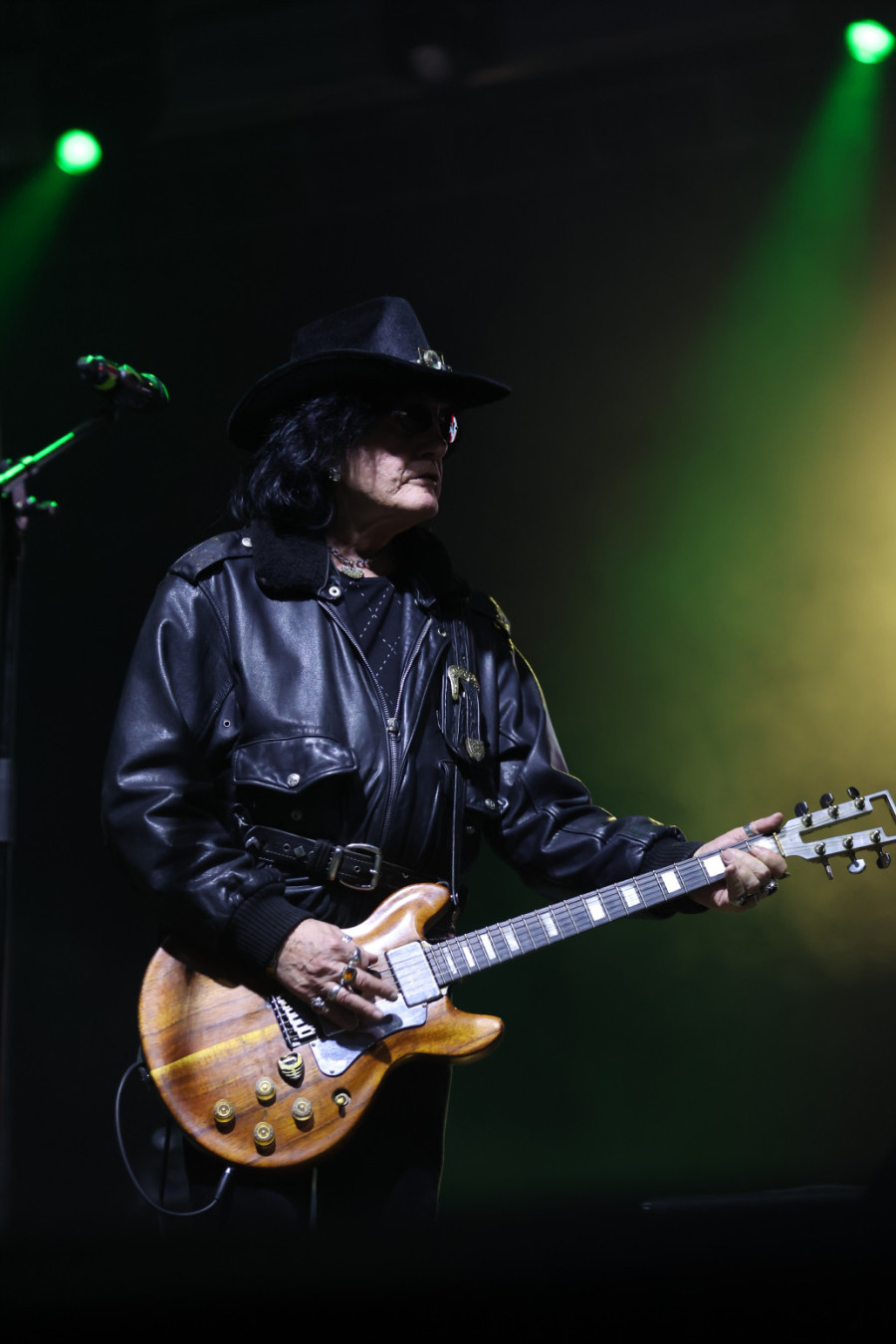 Milić Vukašinović osam dana proveo u komi zbog noge: Bio sam spreman za najgori ishod