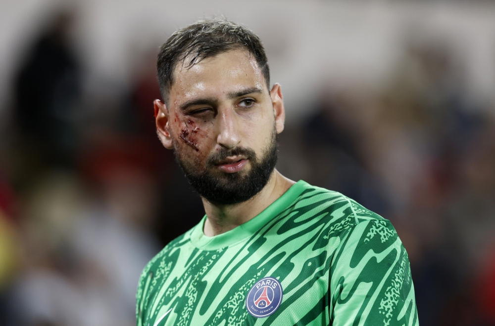 Pobeda PSŽ-a nad Monakom u senci jezive povrede Donarume FOTO/VIDEO