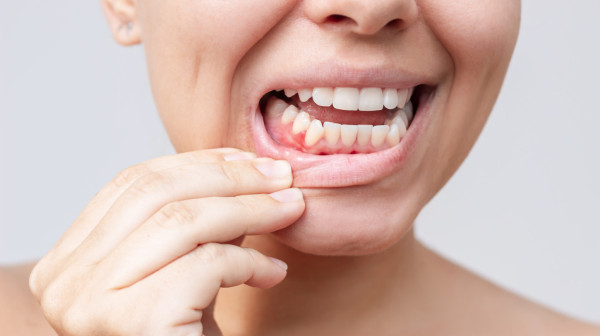 Revolucija u stomatologiji: I odraslima će moći da izrastu novi zubi? VIDEO