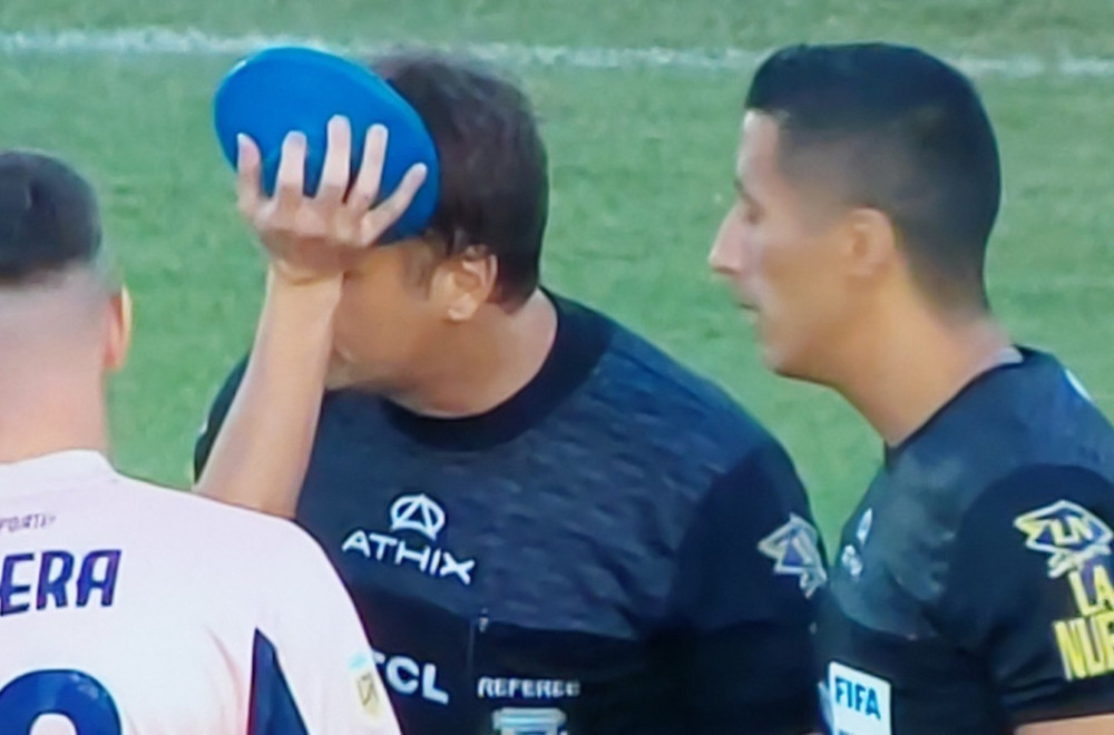 Skandal u Argentini – sudija pogođen šipkom u glavu, utakmica napuštena FOTO