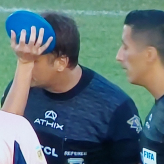 Skandal u Argentini – sudija pogođen šipkom u glavu, utakmica napuštena FOTO