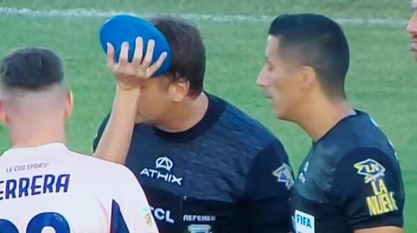 Skandal u Argentini – sudija pogođen šipkom u glavu, utakmica napuštena FOTO