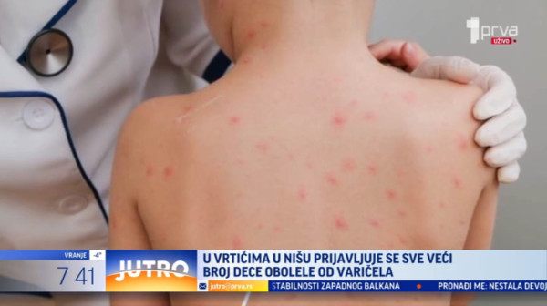 Vrtićka deca na udaru: "Prvo krene od lošeg opšteg stanja" VIDEO