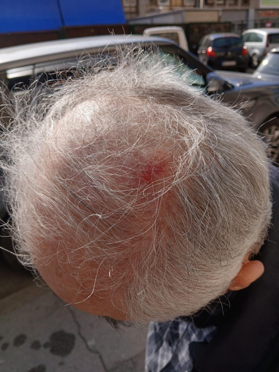 Napad na članove SNS; Nasilnici maltretirali devojku na Dorćolu, a onda fizički nasrnuli FOTO