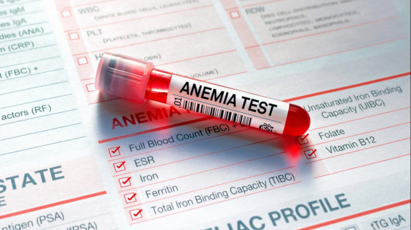 Koji su znaci i simptomi anemije uzrokovane nedostatkom gvožđa